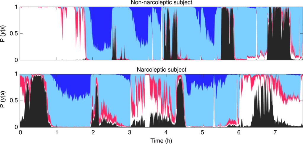 Neural network analysis of sleep stages enables efficient diagnosis of narcolepsy