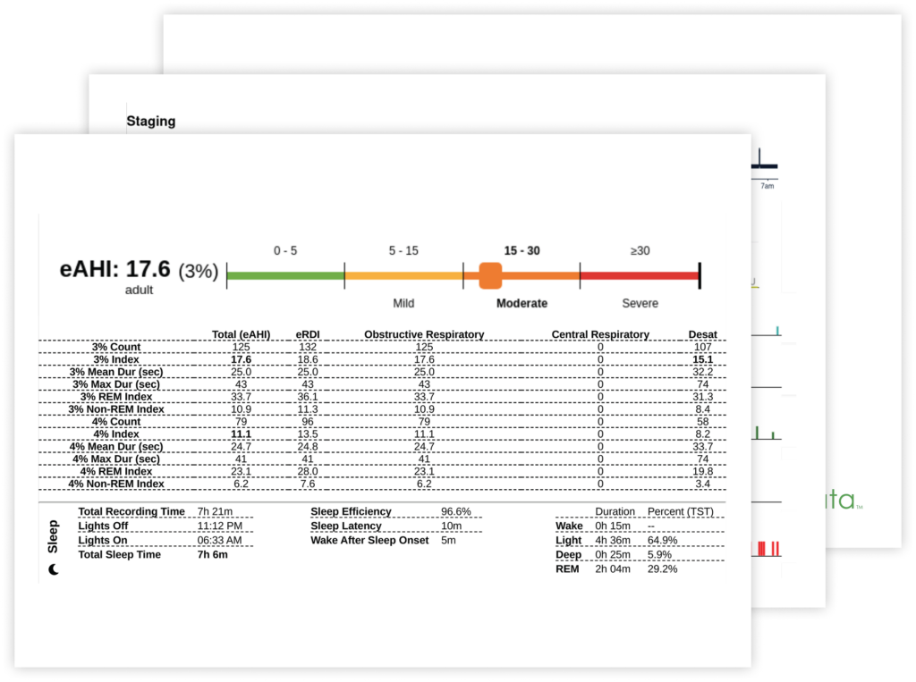 3 Ensosleep reports stacked