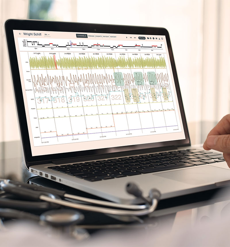 laptop with sleep test results on screen